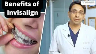 What is Invisalign | ✅How Invisalign works | ✅Benefits of Invisalign |  Eximus Dental, Delhi