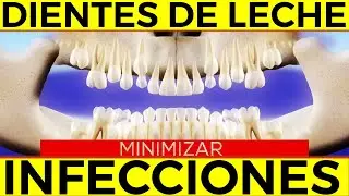 ¿QUÉ PASA CUANDO SE PIERDE UN DIENTE DE LECHE? Riesgos y Consecuencias de la Extracción TEMPRANA
