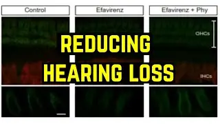 Common supplements might reduce natural hearing loss