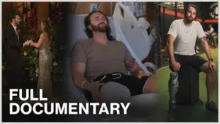 &lsquo;Bachelorette&rsquo; Contestant CHOOSES Amputation and Finds Healing Through FAITH