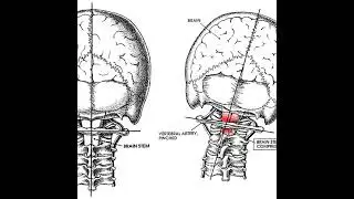 Righting Reflex: The Brain-Body Connection That Never Goes Away