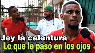 LA RAZÓN POR LO QUE TIENE LOS OJOS DOBLADO NO CREERÁS JEY LA CALENTURA EL MÁS VIRAL DE TIKTOK