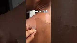 Skin peeling Satisfying 🌊☀️ #gavsventures #summervibes #summer2025 #2025 #summer