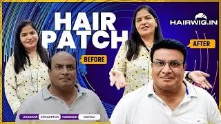 Men Hair Patch | #style #transformation #PinkiSingh #lucknow #trending #viral #hairwig #hair #hair