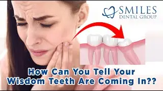 Wisdom Teeth: Important Facts (2025) - How Can You Tell They Are Coming In? What Age To Expect Them?