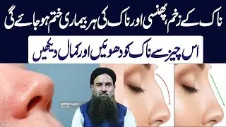 ناک میں زخم پھنسی اور ناک کی ہربیماری کا علاج | Naak me Zakham ka elaj | Dr Sharafat Ali