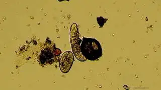 Niesporczaki (Tardigrada) i różne pierwotniaki pod mikroskopem