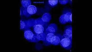 St&oslash;valand - Because I love you (ambient mix)