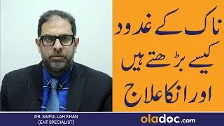 Nasal Polyps Symptoms & Treatment In Urdu - Naak Ke Gadood Ki Alamat - Nasal Polyps Kya Hota Hai