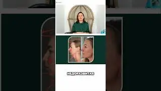 Lower Jaw: Surgery or Method? Real Results!