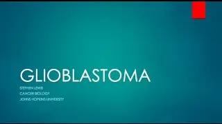 Glioblastoma by Steve Lewis