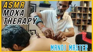 Head Massage and Moxibustion Therapy by MANOJ MASTER💈MASTER ASMR💈#asmr