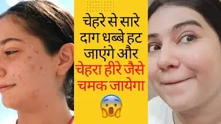 How I Cleared My Textured Skin and Tiny Bumps | बस ये करो चेहरे से सारे दाग धब्बे हट जाएंगे 😱|