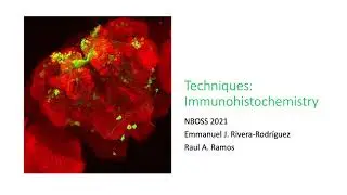 Immunohistochemistry