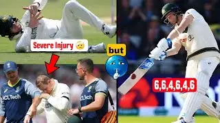 Steve Smith Got Serious Injury but 🤕 Then He Made his Biggest Comeback 🥵 steve smith vs jofra archer