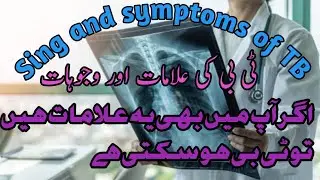 what is tuberculosis | Sign and Symptoms of TB | instructions of tb |medicallab