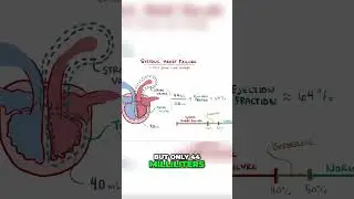 Systolic Heart Failure  Understanding Ejection