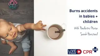 Burns accidents in babies + children