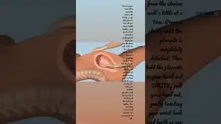 Manual expulsion of placenta#nurses#aiims#ytviral#viral#instareels#reels#mother#placenta
