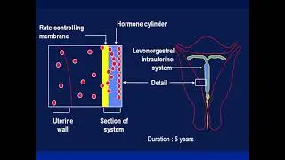 Advances in contraception