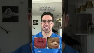 Top 3 Newborn Rashes Explained 👶 | Dr. Yoshi on What&rsquo;s Normal & What Needs Care