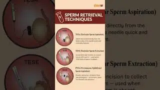 Sperm Retrieval Techniques #spermhealth #tesa #tese #pesa #icsi