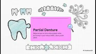 Partial vs. Full Dentures: Restoring Your Smile & Airway Health in Mansfield, TX
