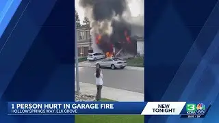 1 injured in Elk Grove garage fire, officials say