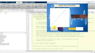 Heart Rate Estimation through detected face realtime using Matlab