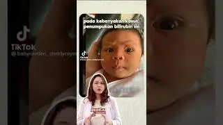 hati-hati bayi lahir kuning!! #bayikuning #edukasianak #penyakitkulit #moell