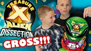 Treasure X Alien Dissection Kit FINALLY opened!