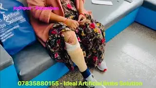 Nakli Per l Artificial Leg l best artificial limb clinic l Best knee | Effects with Jaipur foot |