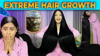 Most Powerful DIY For Massive Hairgrowth 🙆&zwj;♀️ I Applied Few Drops Of This And Results were Shocking 