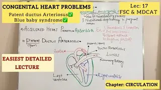 Congenital heart problems (Patent ductus Arteriosus & Blue baby syndrome) | class 11 biology