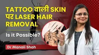 Can Laser Hair Removal Damage Your Tattoo? | Tattoo पर Laser Hair Removal हो सकता है? | Clear Skin