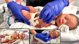 Update On Baby Jayceon, Diagnosed With Down Syndrome 🙏🏾