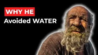 He Avoided Water for 67 Years (And Rabies Wasn&rsquo;t the Reason)