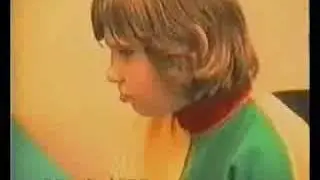 CREALAB. Синдром Дауна. До и После.