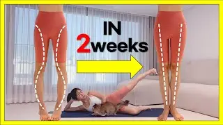 Get Straight Legs in 2weeks | Fix O or X-Shaped Legs (Knee Internal Rotation)