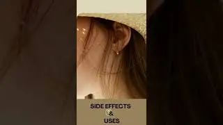 Stemetil MD Tablet | Ear balance | ചെവി പ്രശ്നങ്ങൾ | വെർട്ടിഗോ #youtubeshorts #reels #medicine