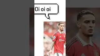 oi oi oi antony