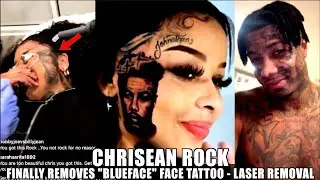 Chrisean l&auml;sst sich ihr Blueface-Tattoo entfernen | Laser-Tattooentfernung #chriseanrock