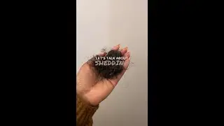 Let's Talk About Hair Shedding