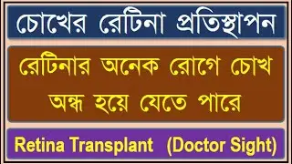Retina Transplant: #retina #retinalDiseases #retinaTransplant #DoctorSight #doctorsight