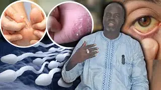 ✍️RÉPONSE : Ndoxoum Siti Signe et Solution / Formation internet - Pr Ousmane Ndiaye - SAMA XALAAT TV