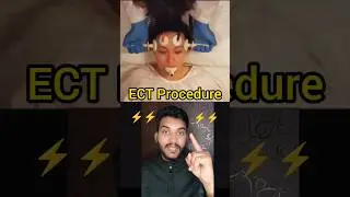 ECT procedure