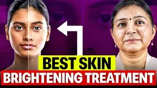 Best Skin Brightening Treatment for Dull & Uneven Skin | Saraswat Hospital Cosmetic Surgery