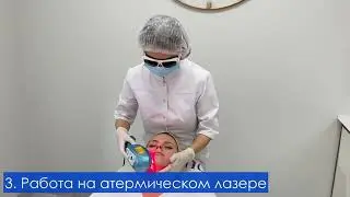 Лазерная биоревитализация Byonik