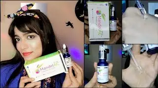 MandeLAC Acid Serum Reality | it burnt my skin 😢