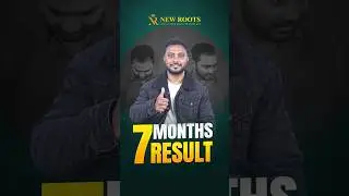 3100 Grafts Hair Transplant in Bangladesh | Cost & Best Results #hairtransplant #shorts